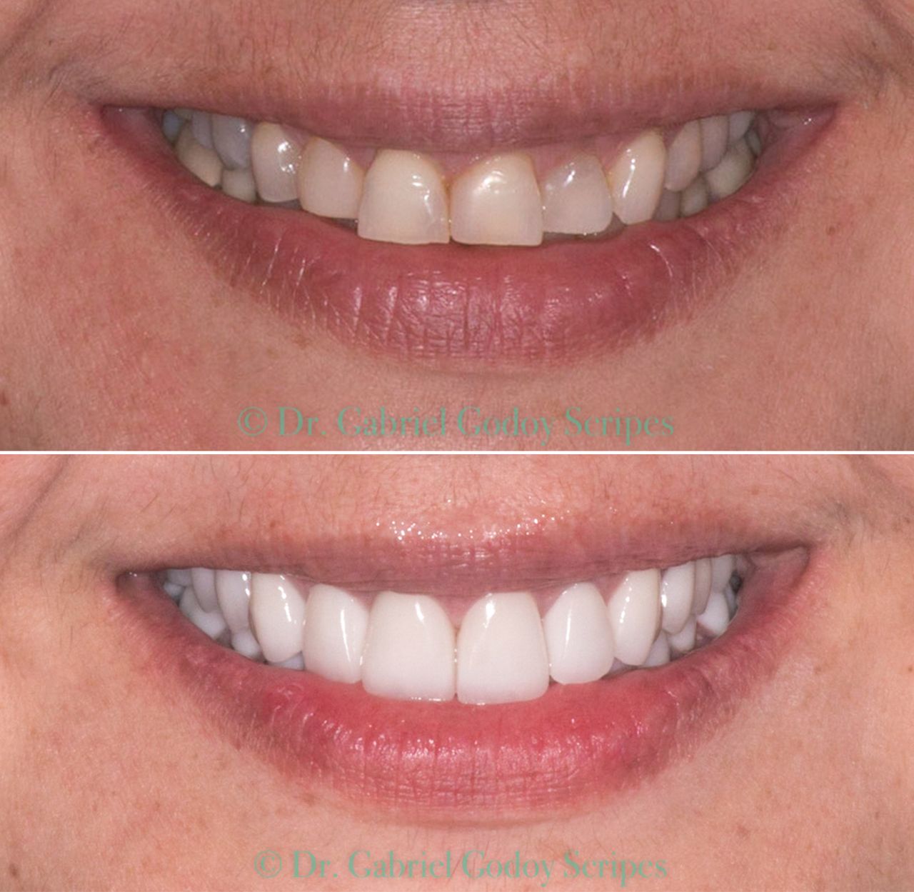 Gabriel Godoy Scripes-28