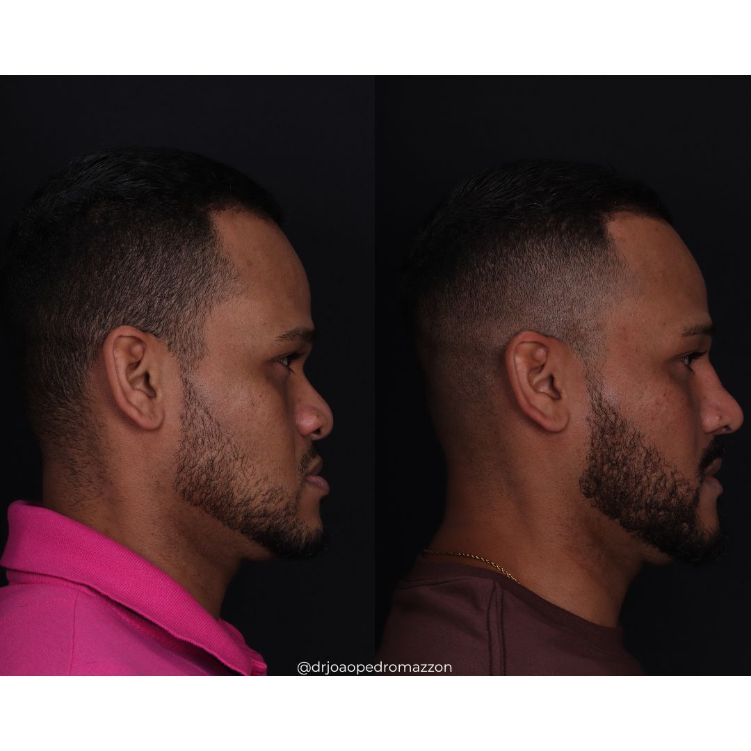 João Pedro Paulino Mazzon-58