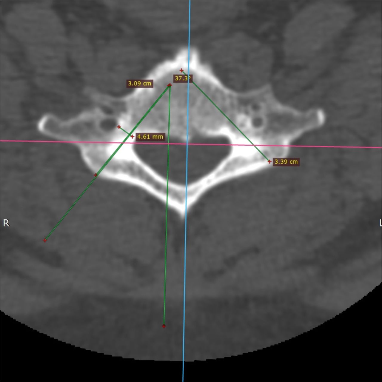 David Tafur Muñoz-1779