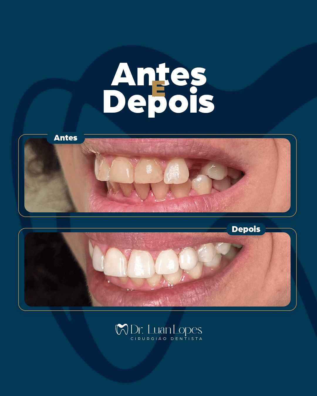 Luanderson Lopes Pereira-7