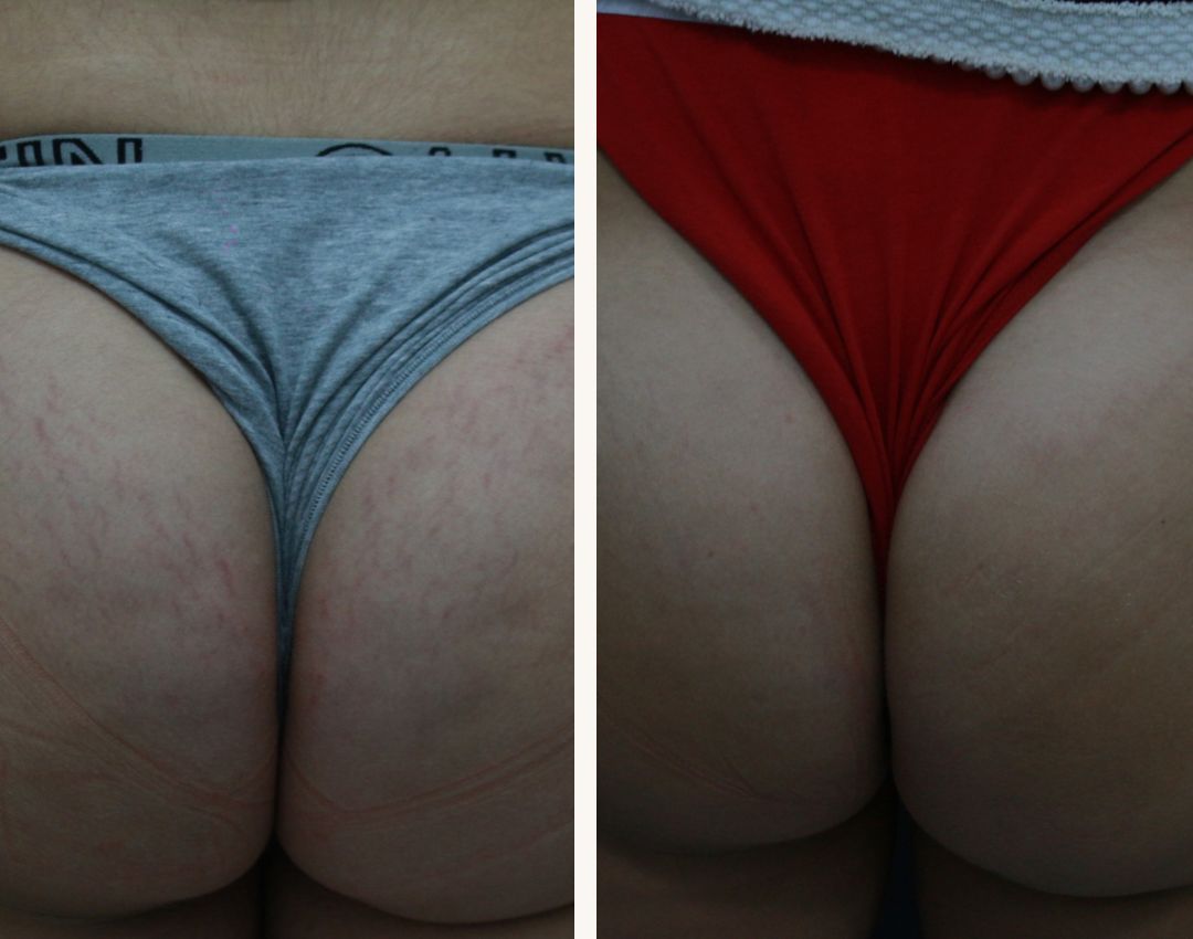 Ivan Diazgranados Fernandez-11