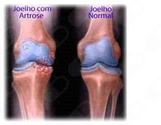 Jose Henrique Pellegrini-4