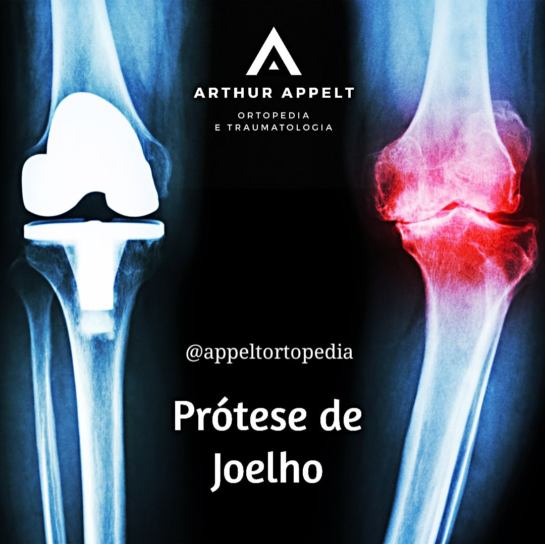 Arthur Lanna Appelt-1