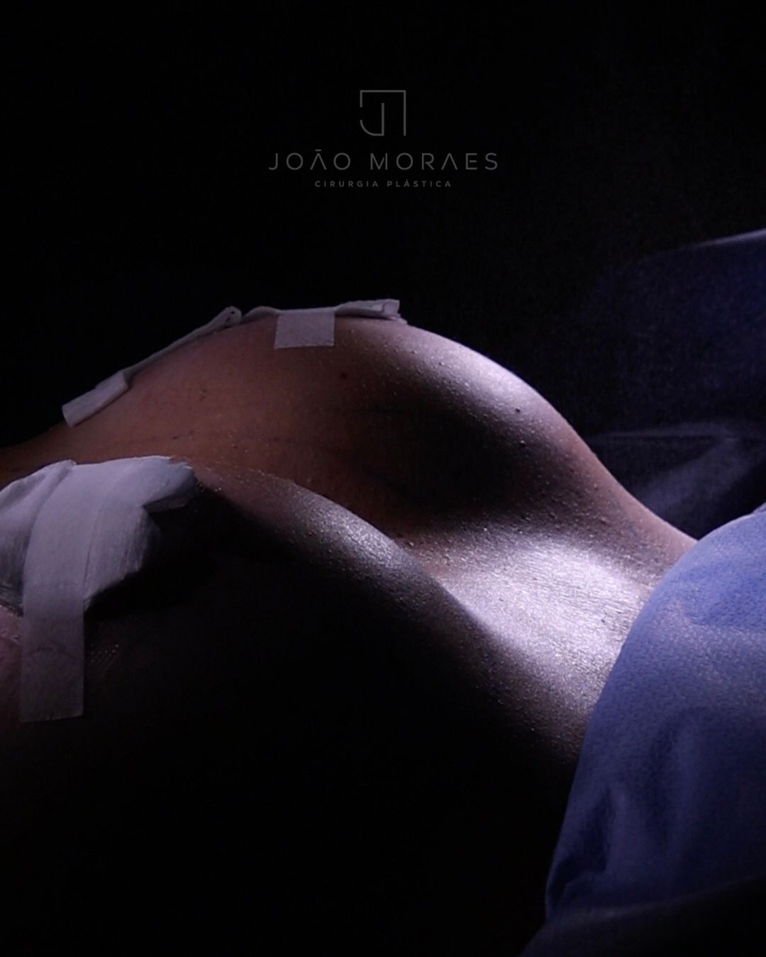 João Moraes-5