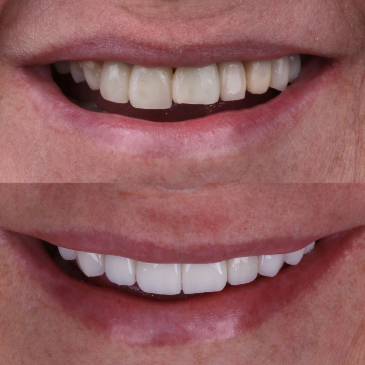 Daniel De Souza Pereira-45