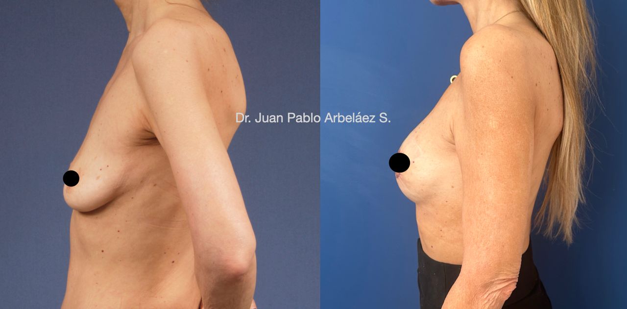 Juan Pablo Arbeláez Sierra-29