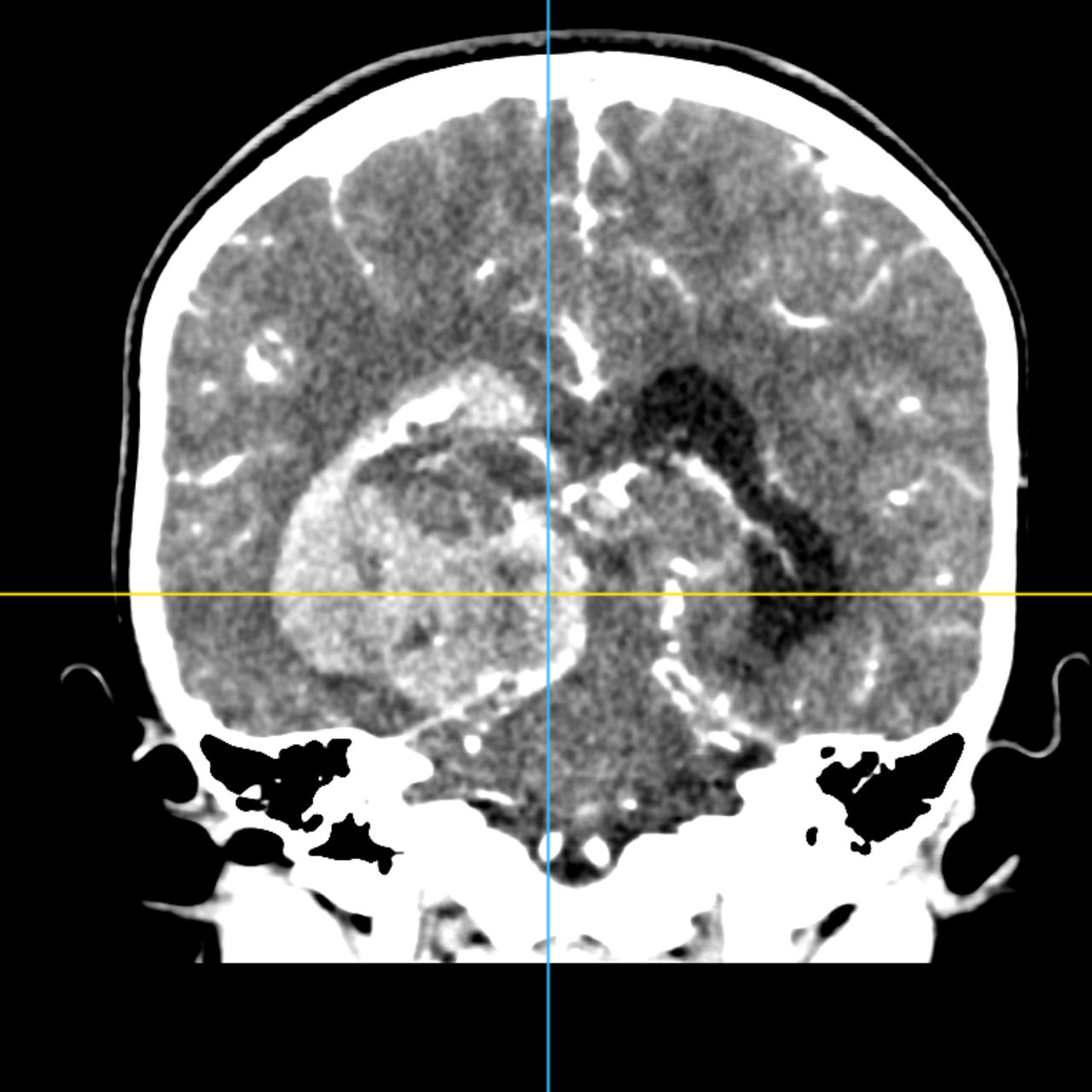 David Tafur Muñoz-1790