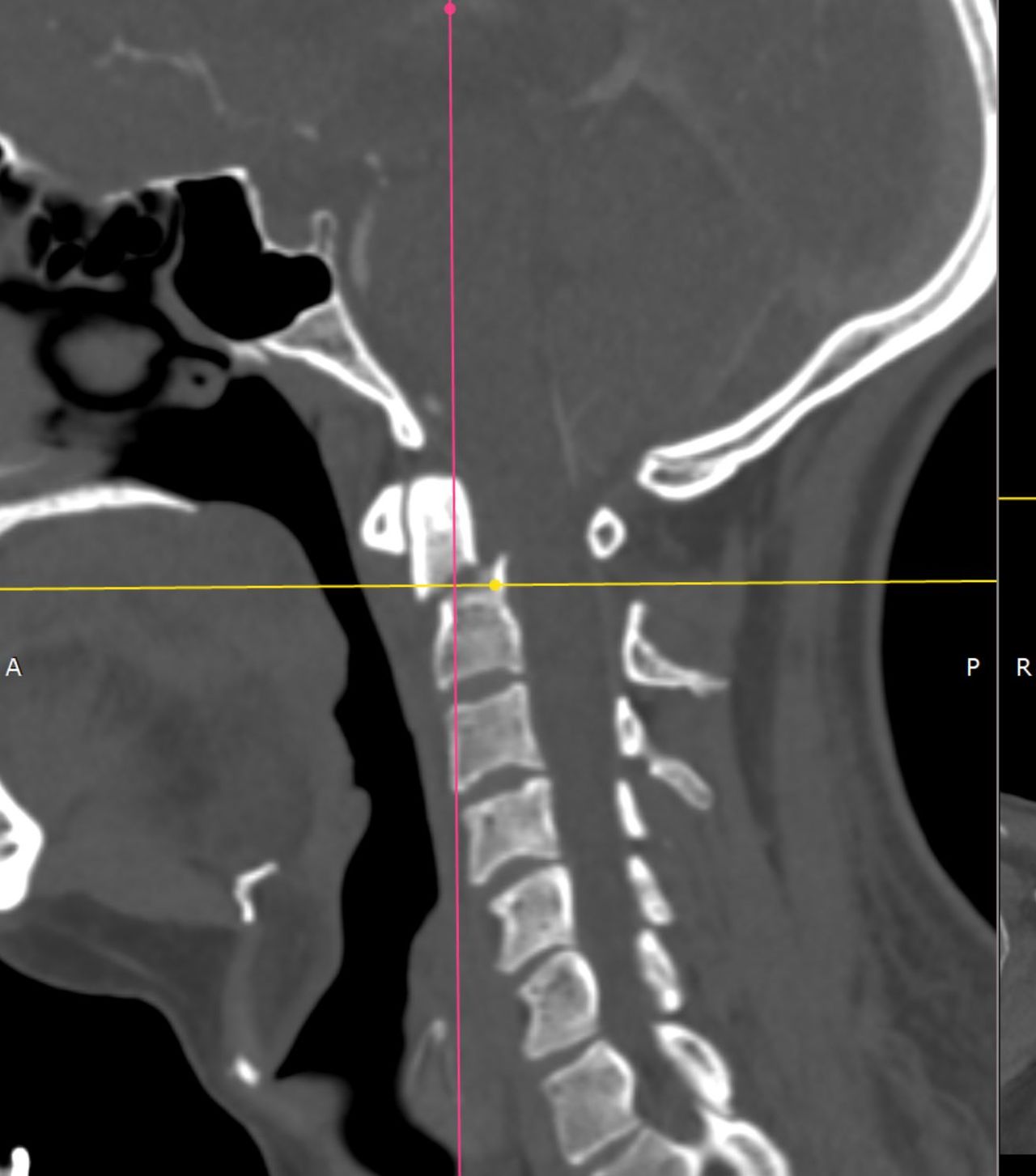 David Tafur Muñoz-1077