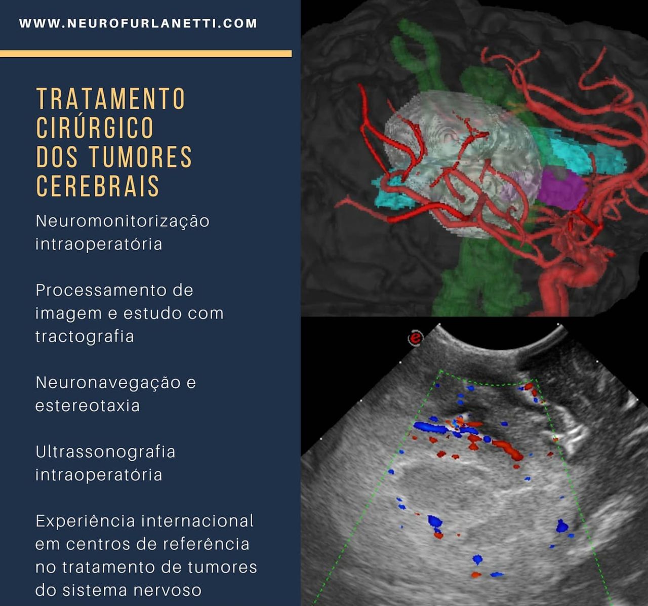 Luciano Furlanetti-11