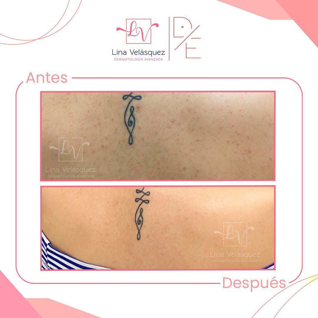 Lina Velásquez Tafur-9