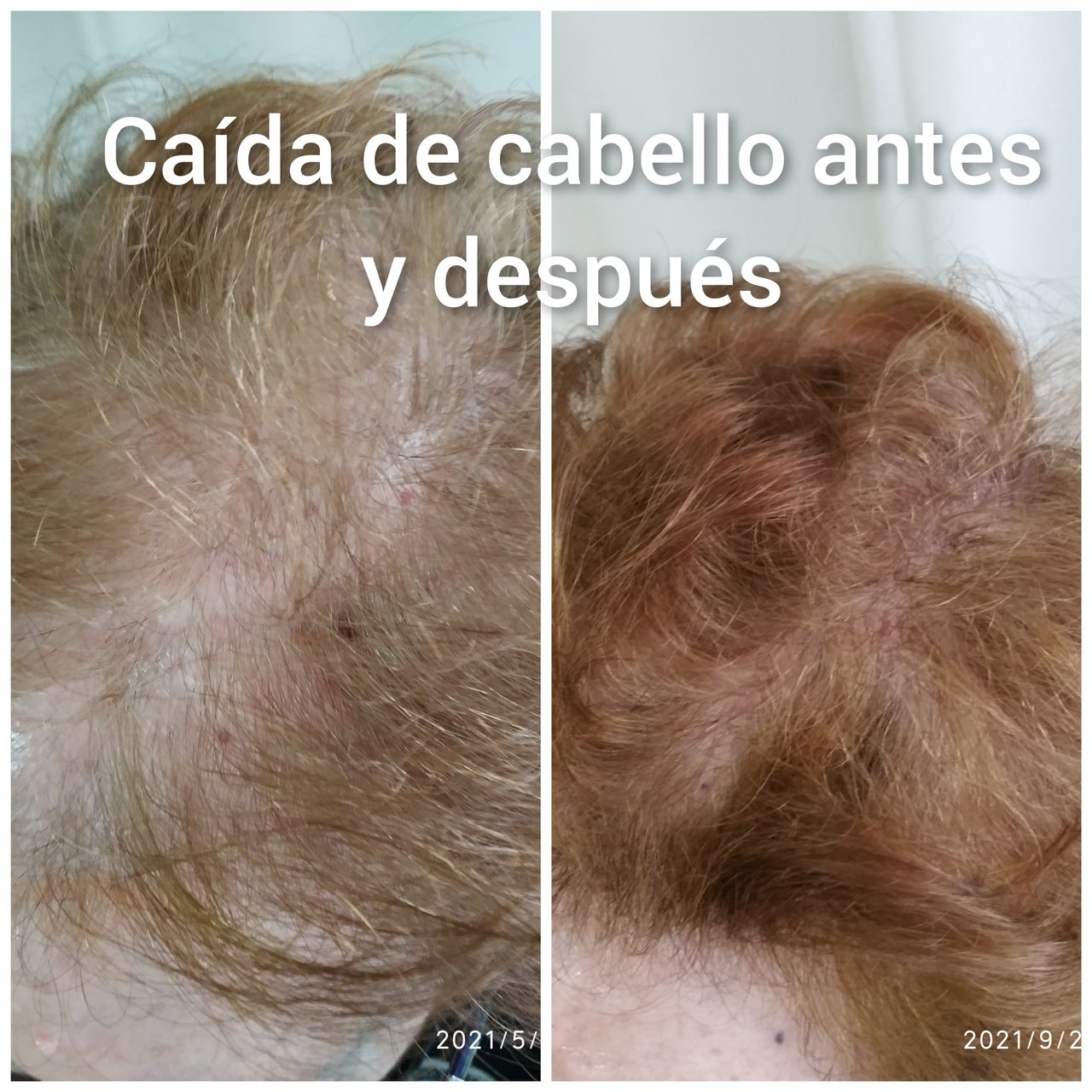 Alejandra Meijide-25