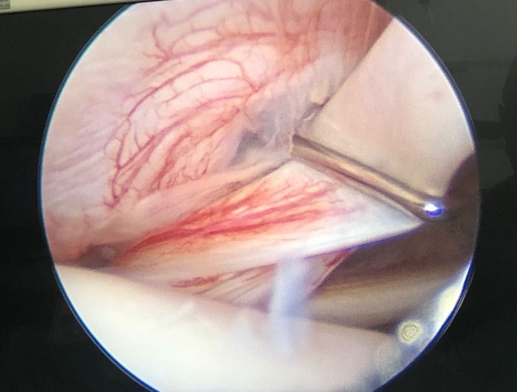 Andres De La Espriella Rosales-53