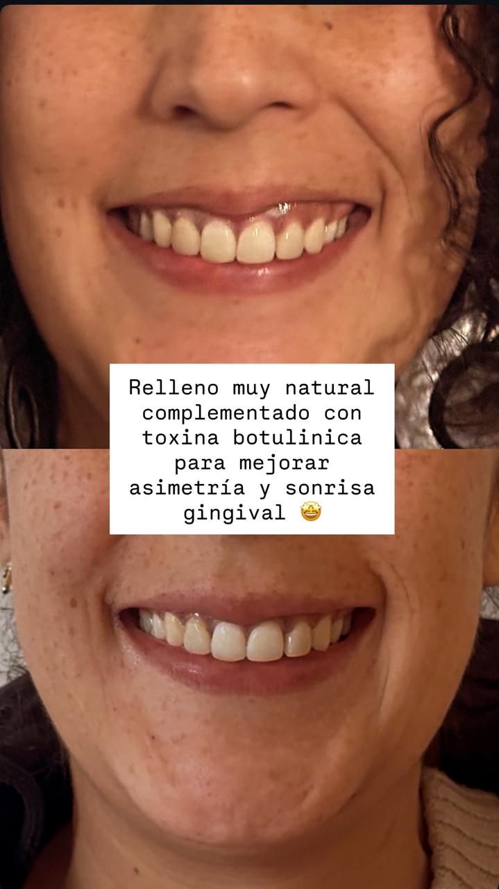 Camila Forni Aguayo-1