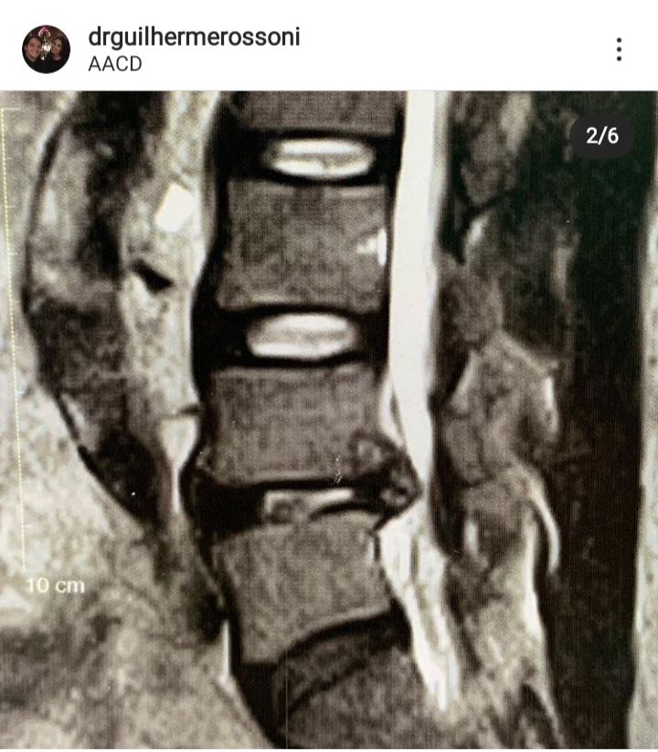 Guilherme Rossoni-14