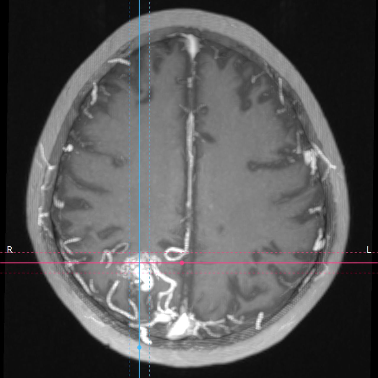 David Tafur Muñoz-2282