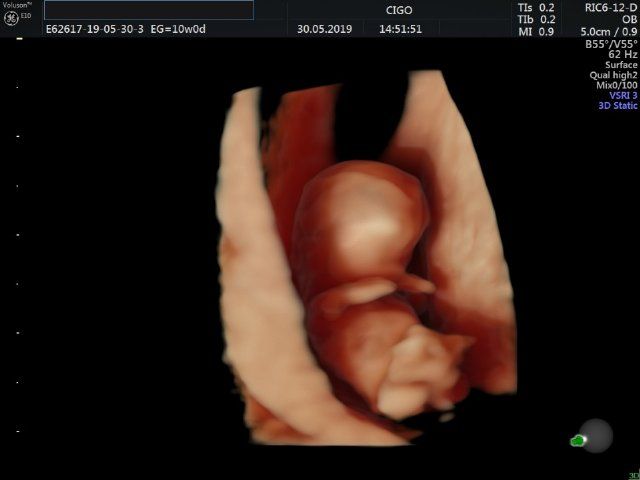 Raul Javier Banderas Pumarino-15