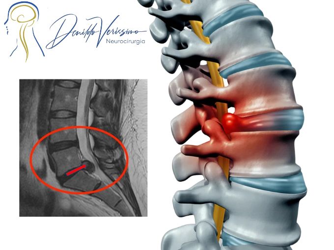 Denildo Veríssimo-18