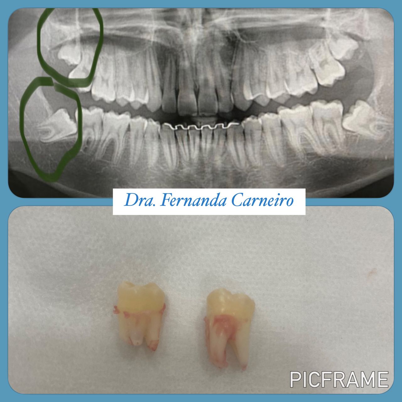 Fernanda Carneiro Pinto-29