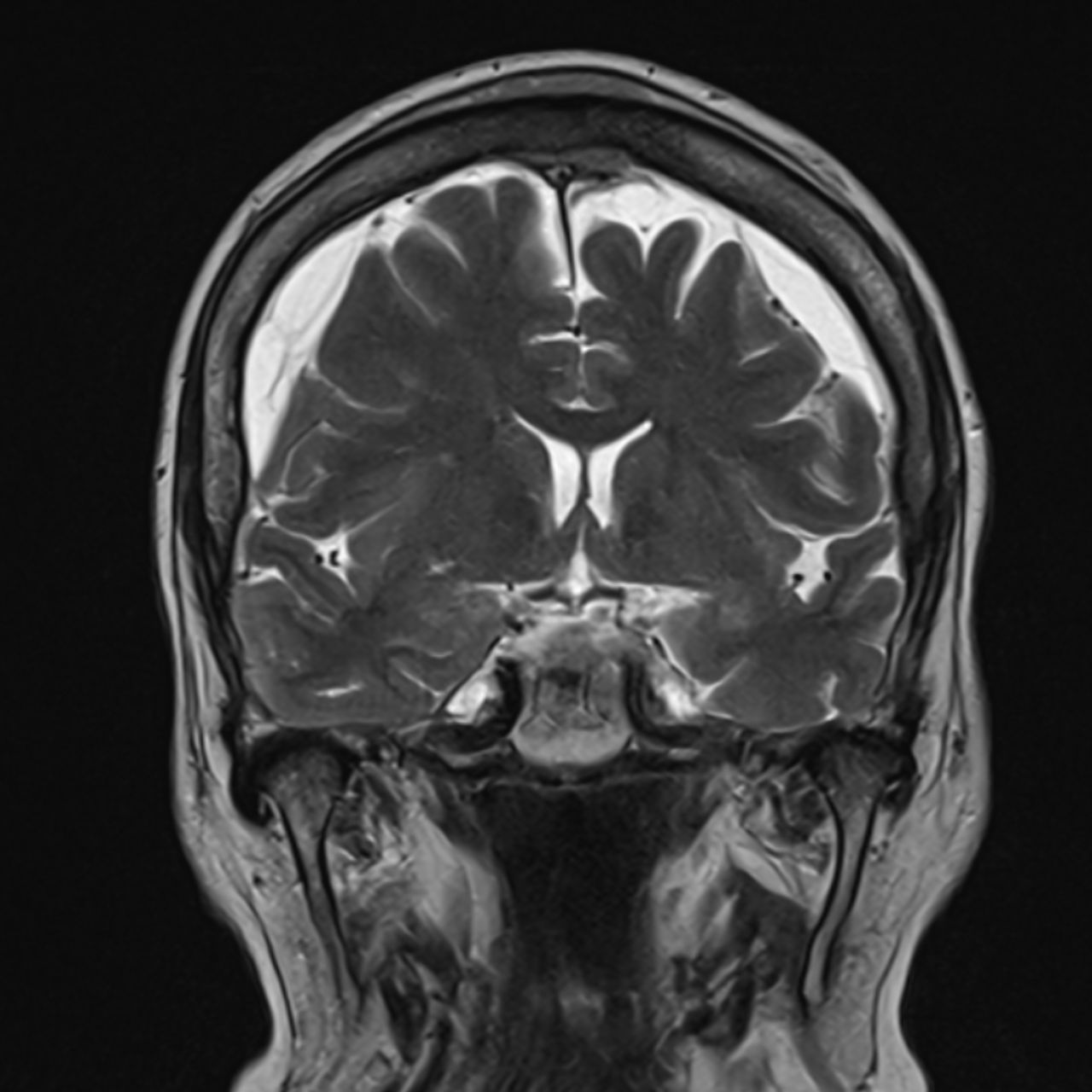 David Tafur Muñoz-1543