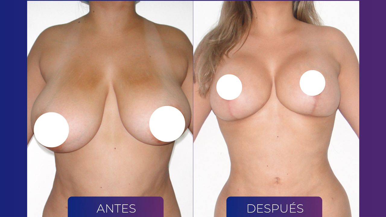 Alexander Mendoza-44