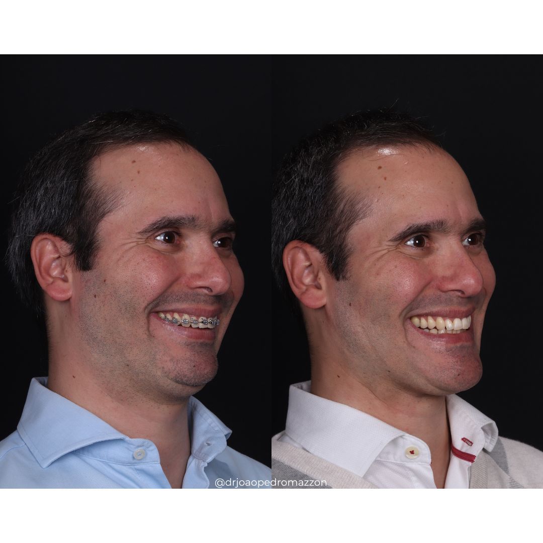 João Pedro Paulino Mazzon-49