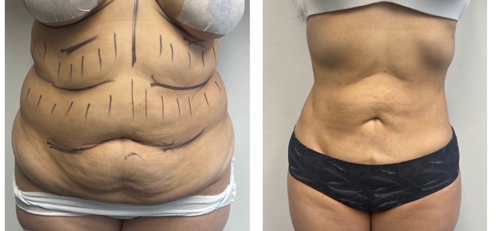 Fernando Oviedo Monsalve-4