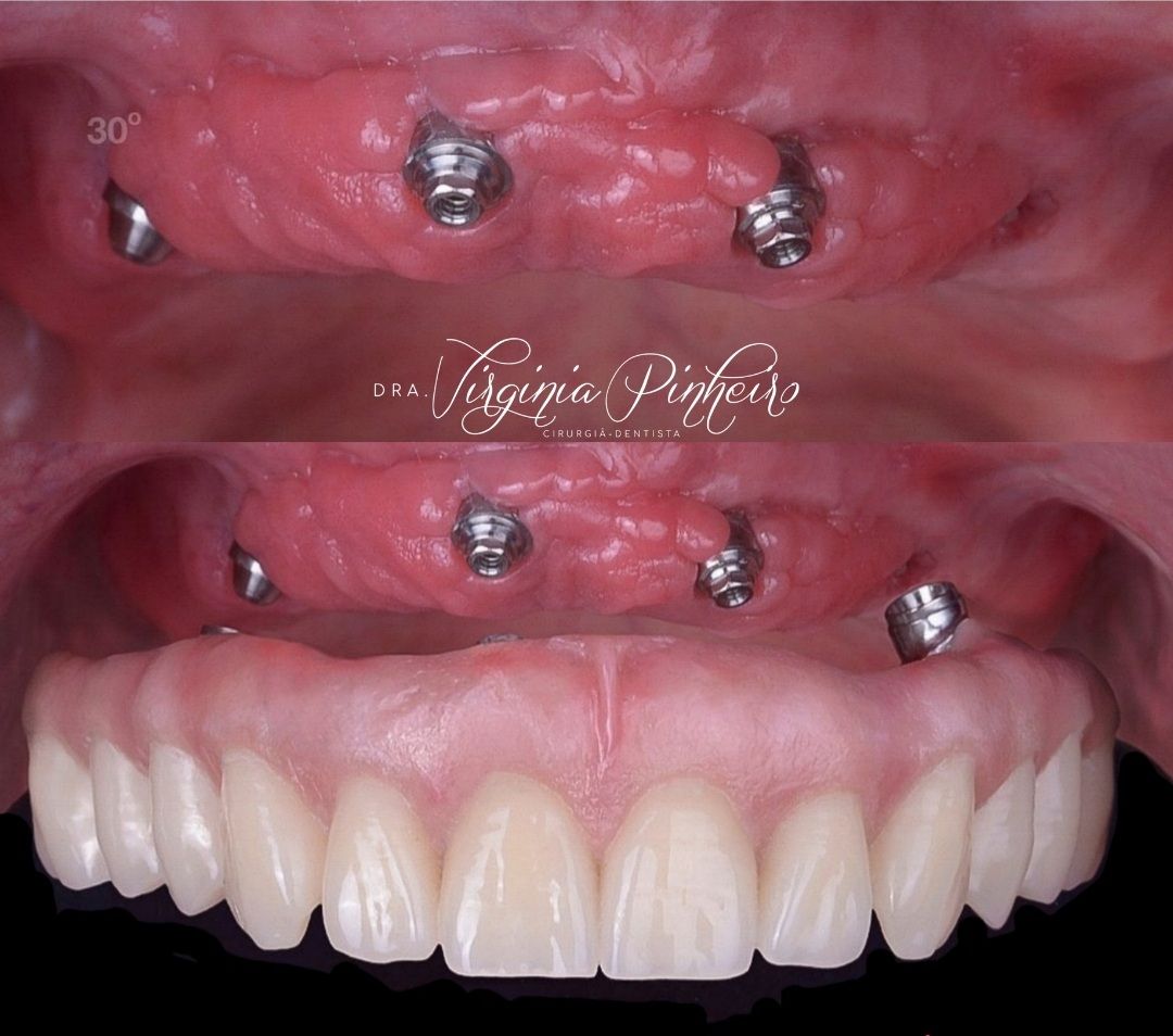 Ana Virginia  Pinheiro -4