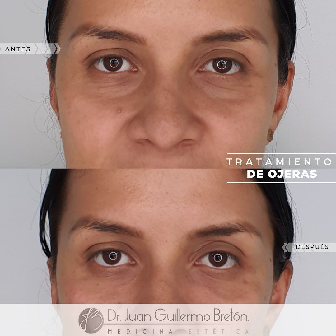 Juan Guillermo Bretón Franco-19