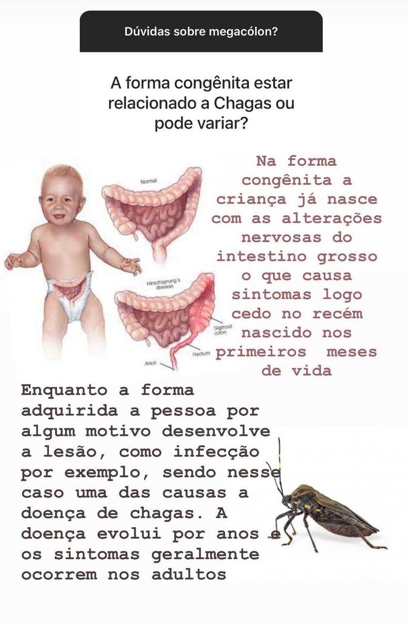 Nelson Bisneto-28