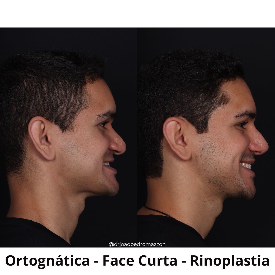 João Pedro Paulino Mazzon-15