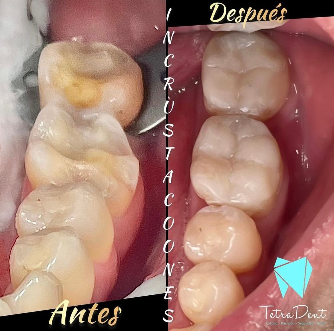 Andrés Chumbiray Rodríguez-4