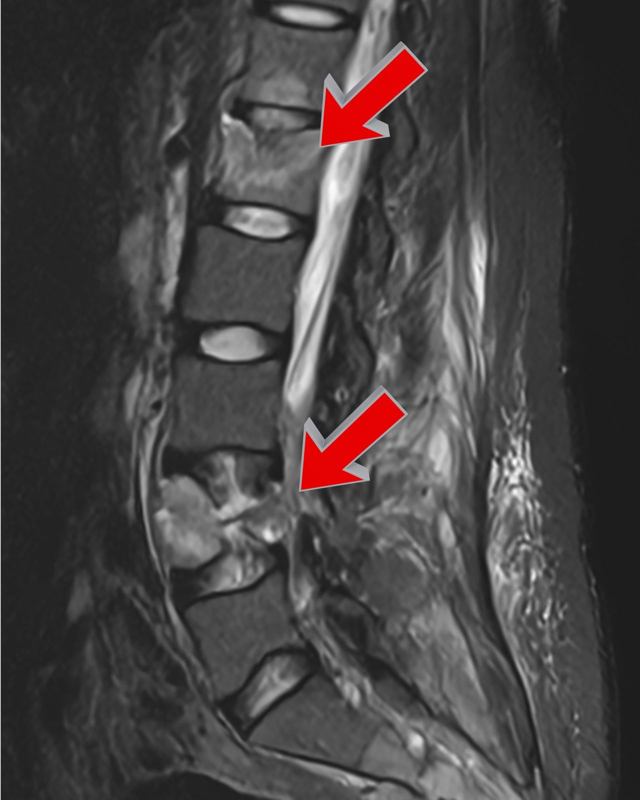 David Tafur Muñoz-1079