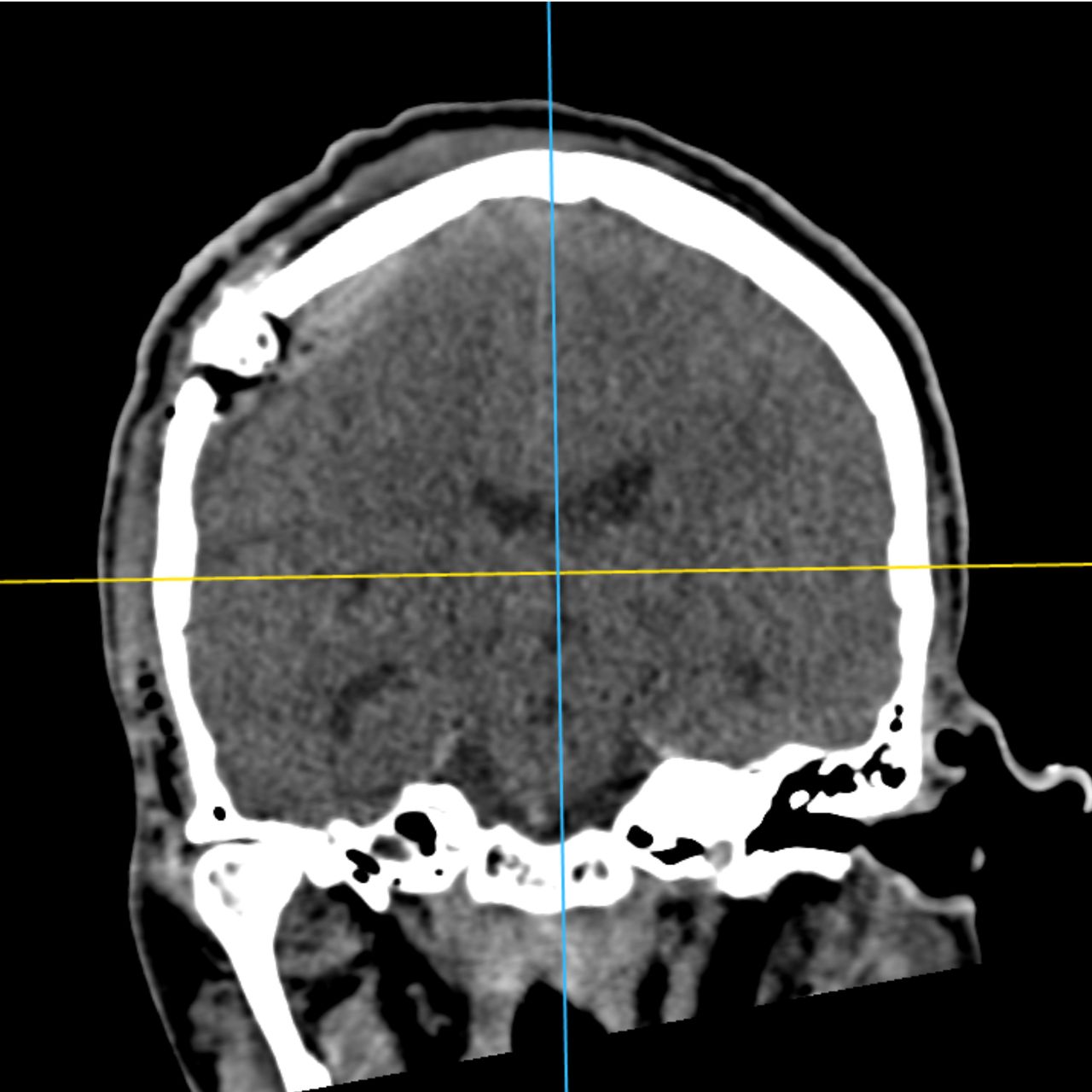 David Tafur Muñoz-1939