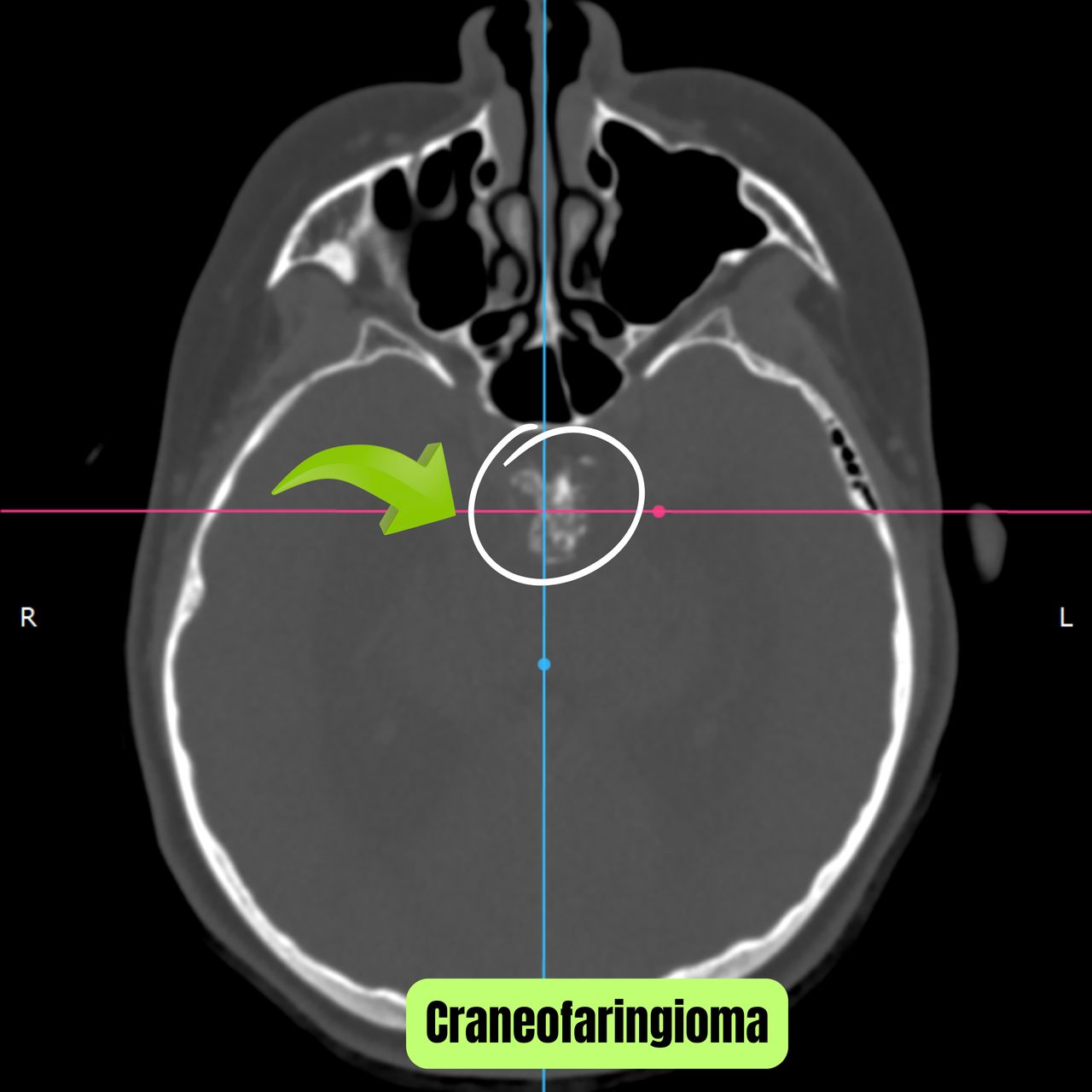 David Tafur Muñoz-2214
