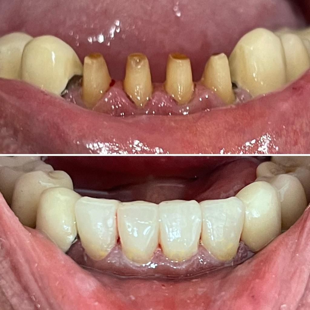 Fernanda Archipéva-15