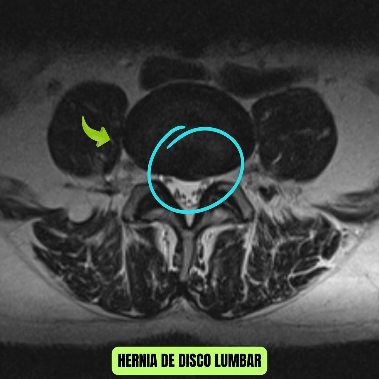 David Tafur Muñoz-1682