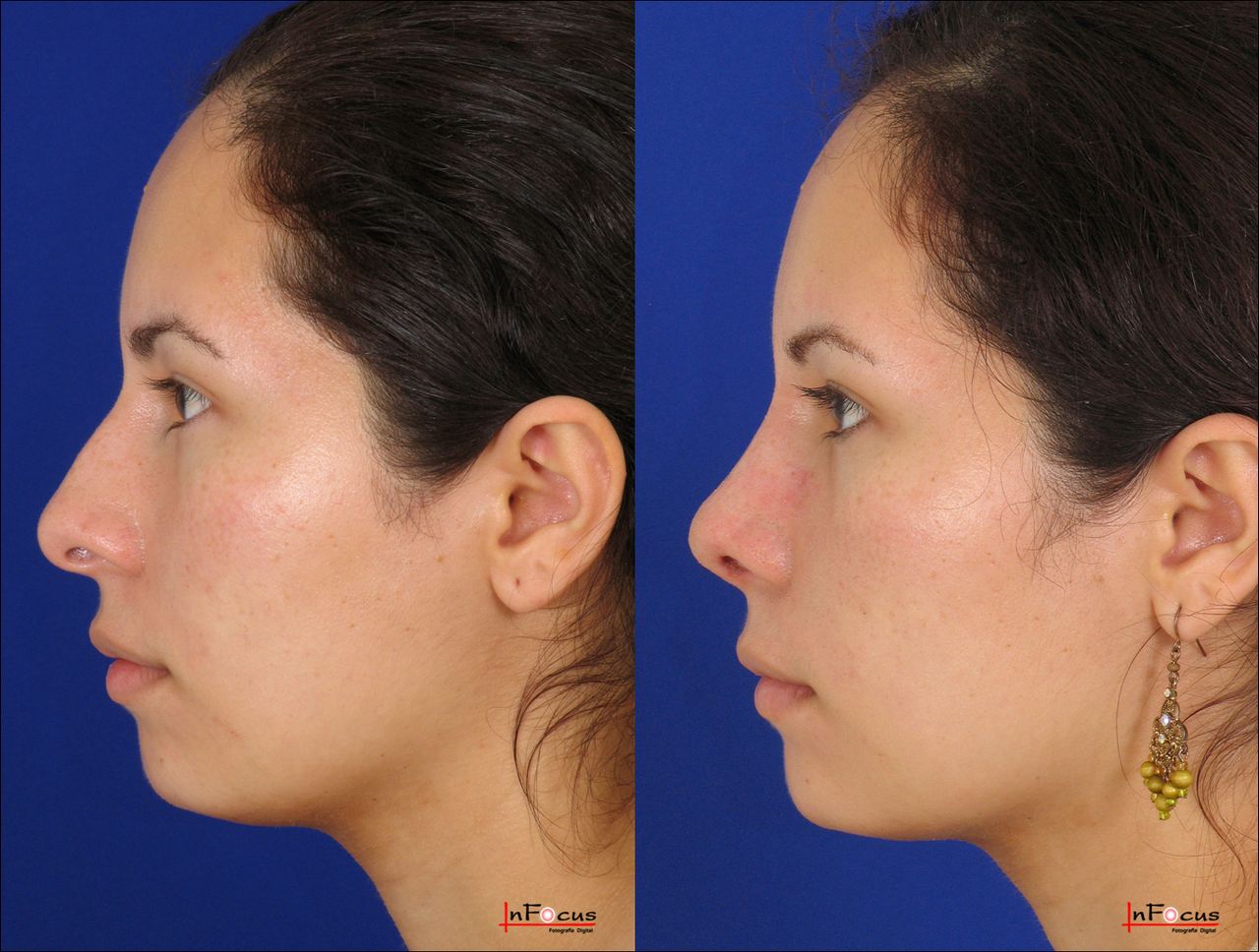 Jorge A Holguin Ruiz-34