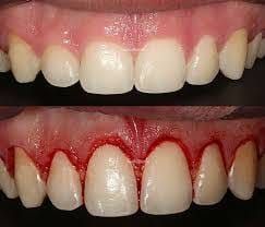 Rosemary Carneiro De Sá-52