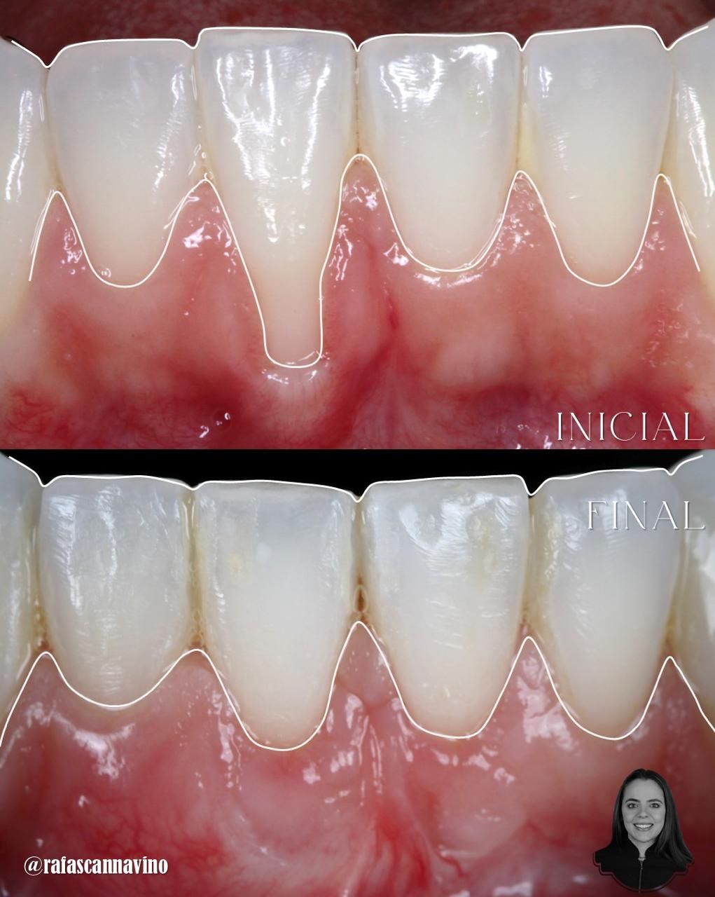 Gabriel Lucio Calazans Duarte-4