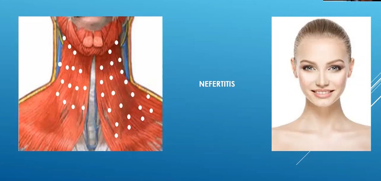 Erika Concha Troncoso-10