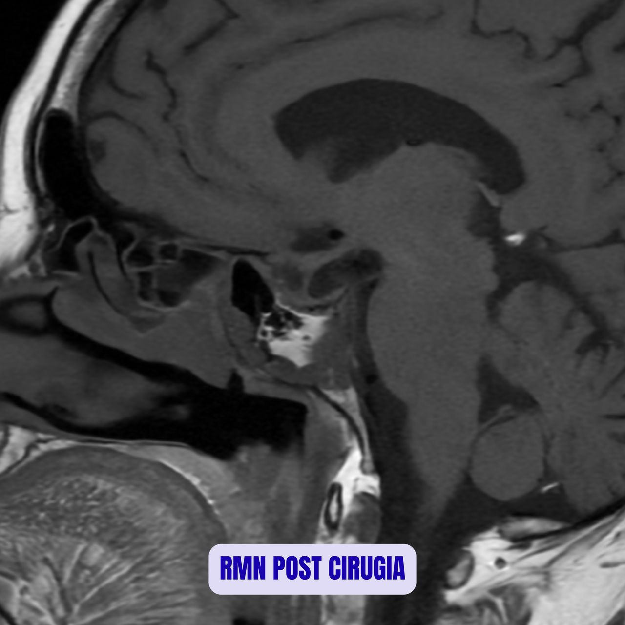 David Tafur Muñoz-1734