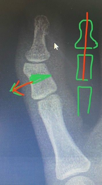 Maria Esther Castillo García-5