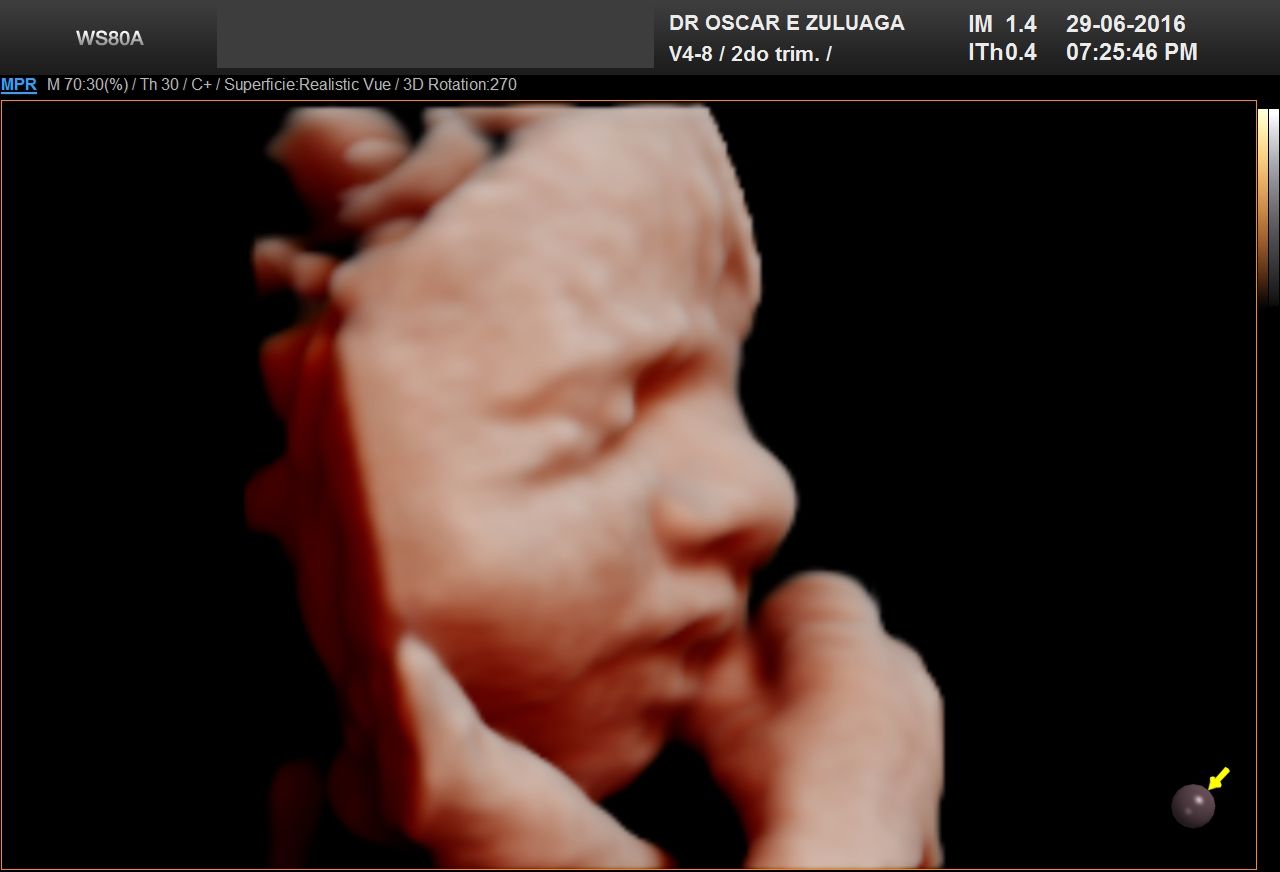 Oscar Elías Zuluaga Cortés-5