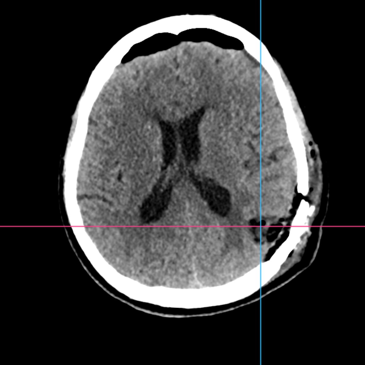 David Tafur Muñoz-2096