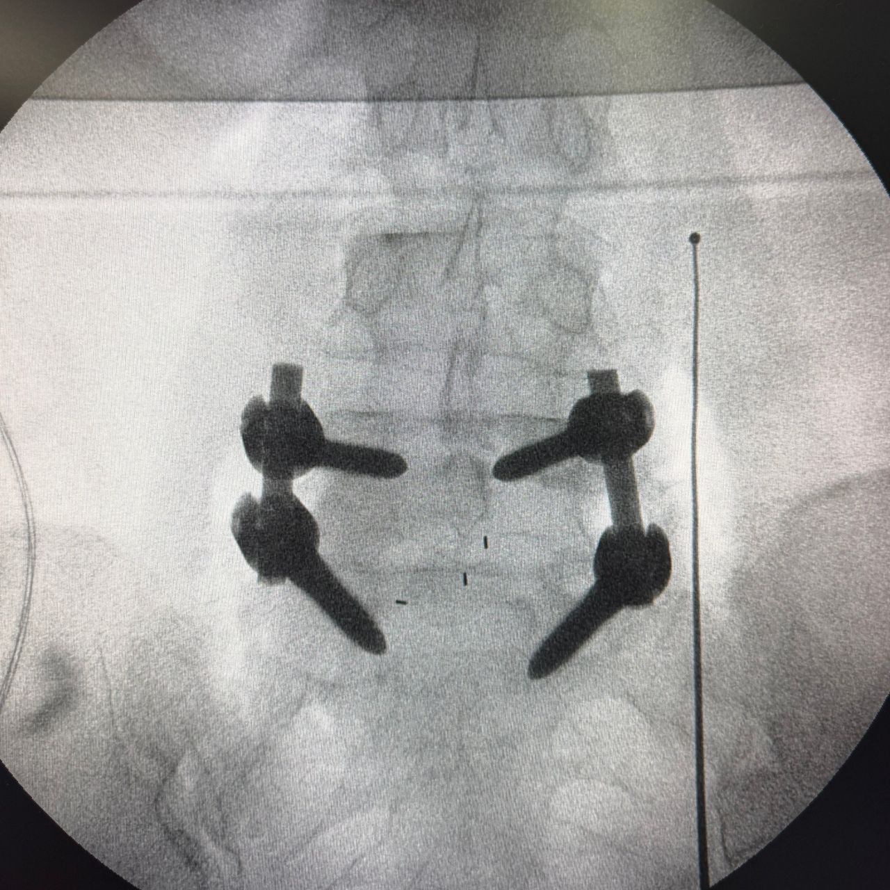 David Tafur Muñoz-2364