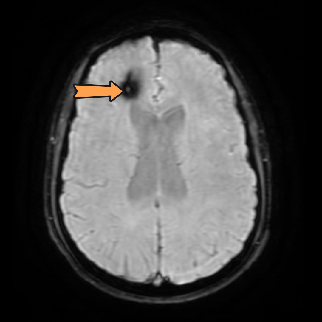 David Tafur Muñoz-2331