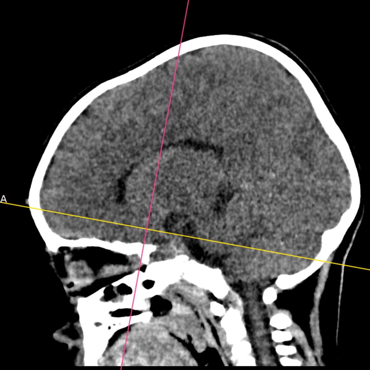 David Tafur Muñoz-1539