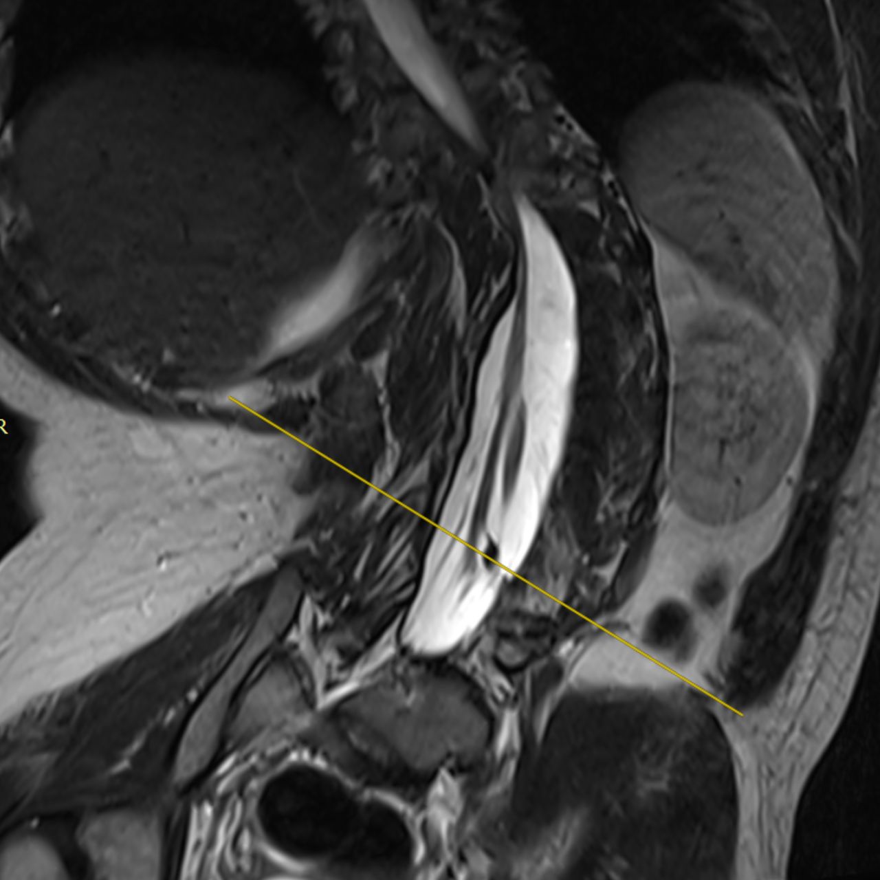 David Tafur Muñoz-1512