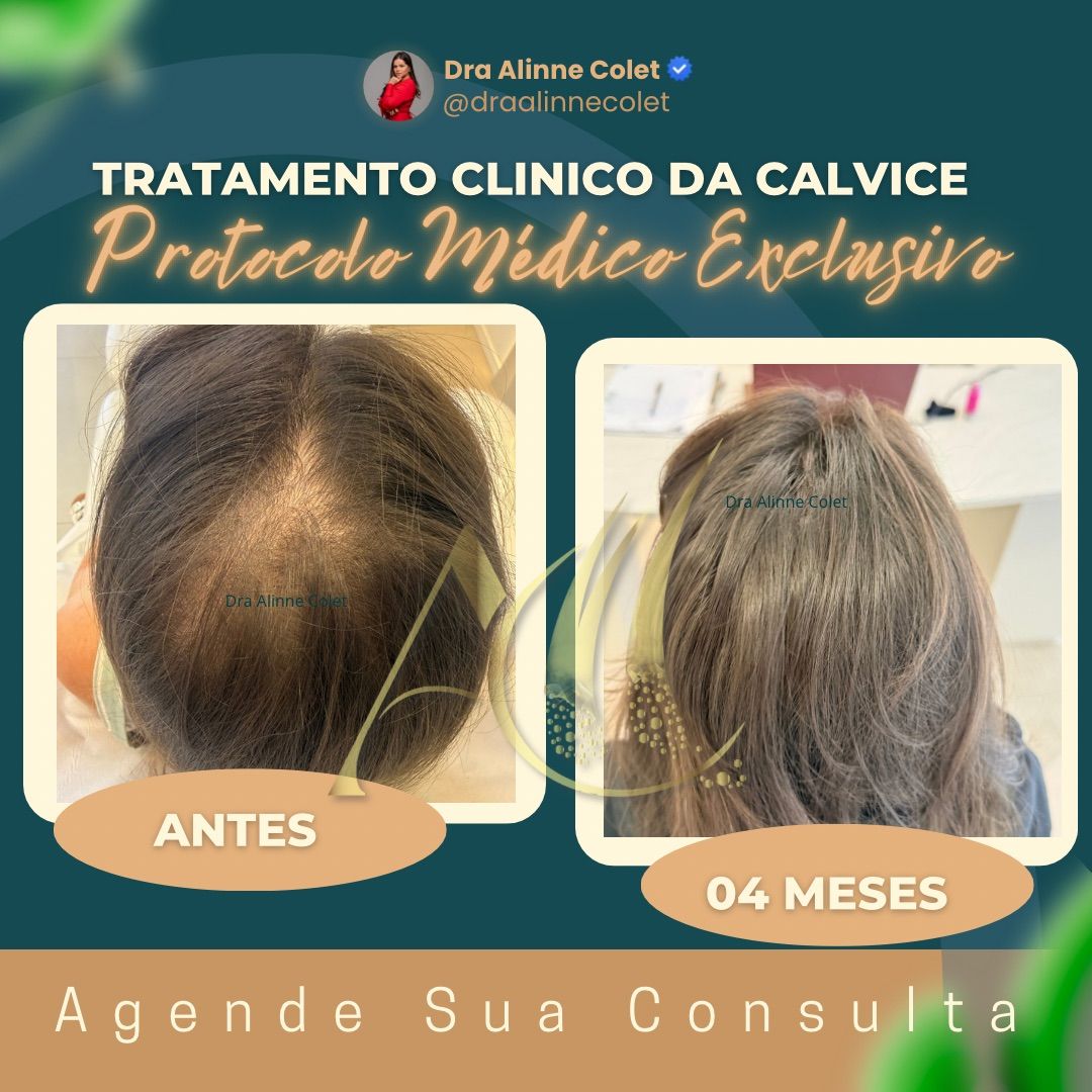 Alinne Gerssica Soares Colet-0