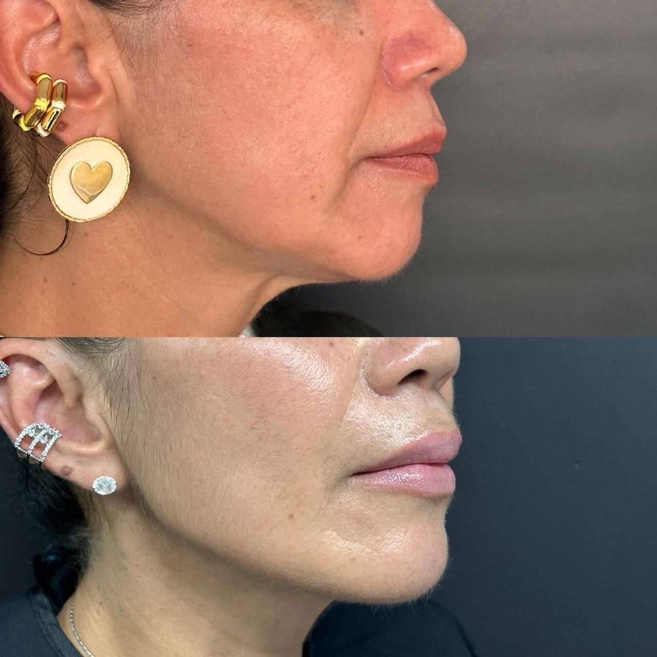 Andrés Felipe Barreto Galeano-28